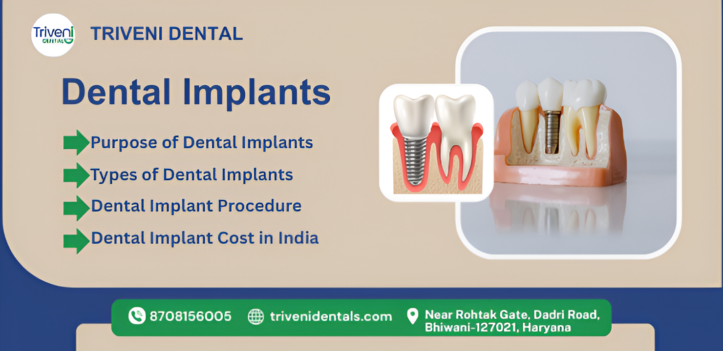 Dental Implants: Surgery, Purpose, Procedure & Benefits