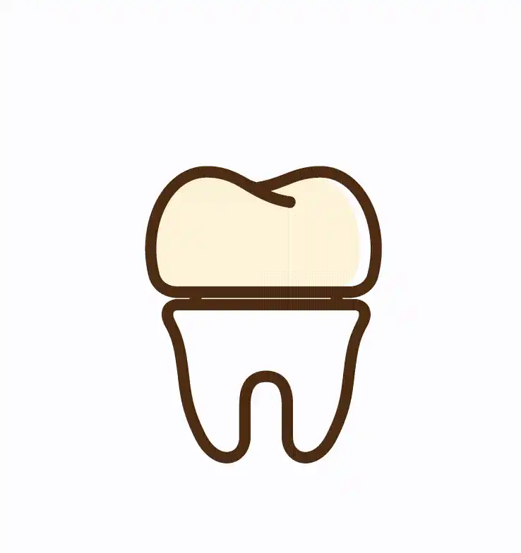 Dental Crowns