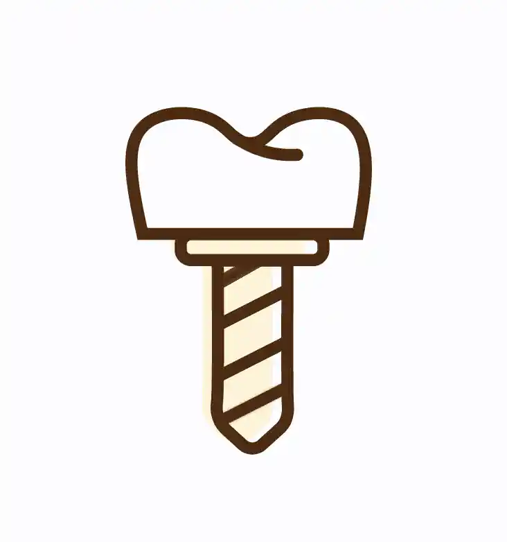 Dental Implants / Teeth Implants