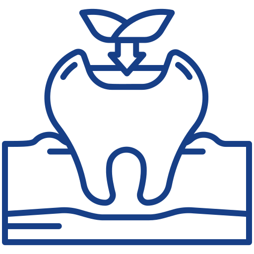 Dental Fillings / Teeth Fillings
