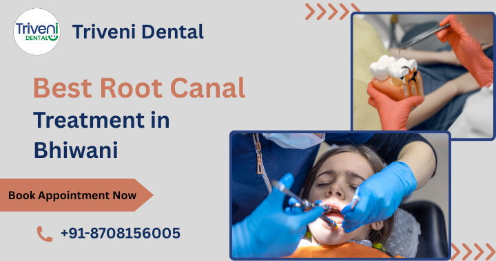 Root Canal Treatment in Bhiwani – Need, Cost & Best Doctors