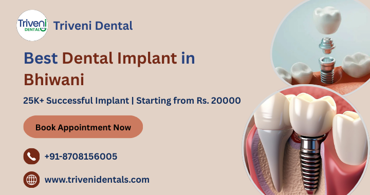 Best Dental Implant in Bhiwani | Cost & Best Implant Dentist