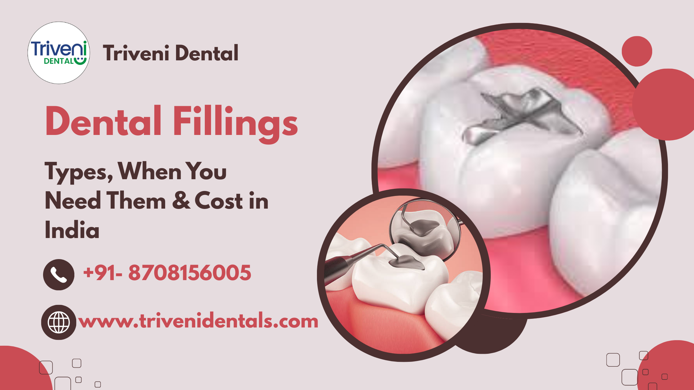 Dental Fillings: Types, When You Need Them & Cost in India
