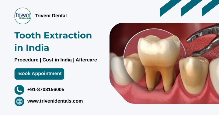 Tooth Extraction: Procedure, Side effects and Cost in India