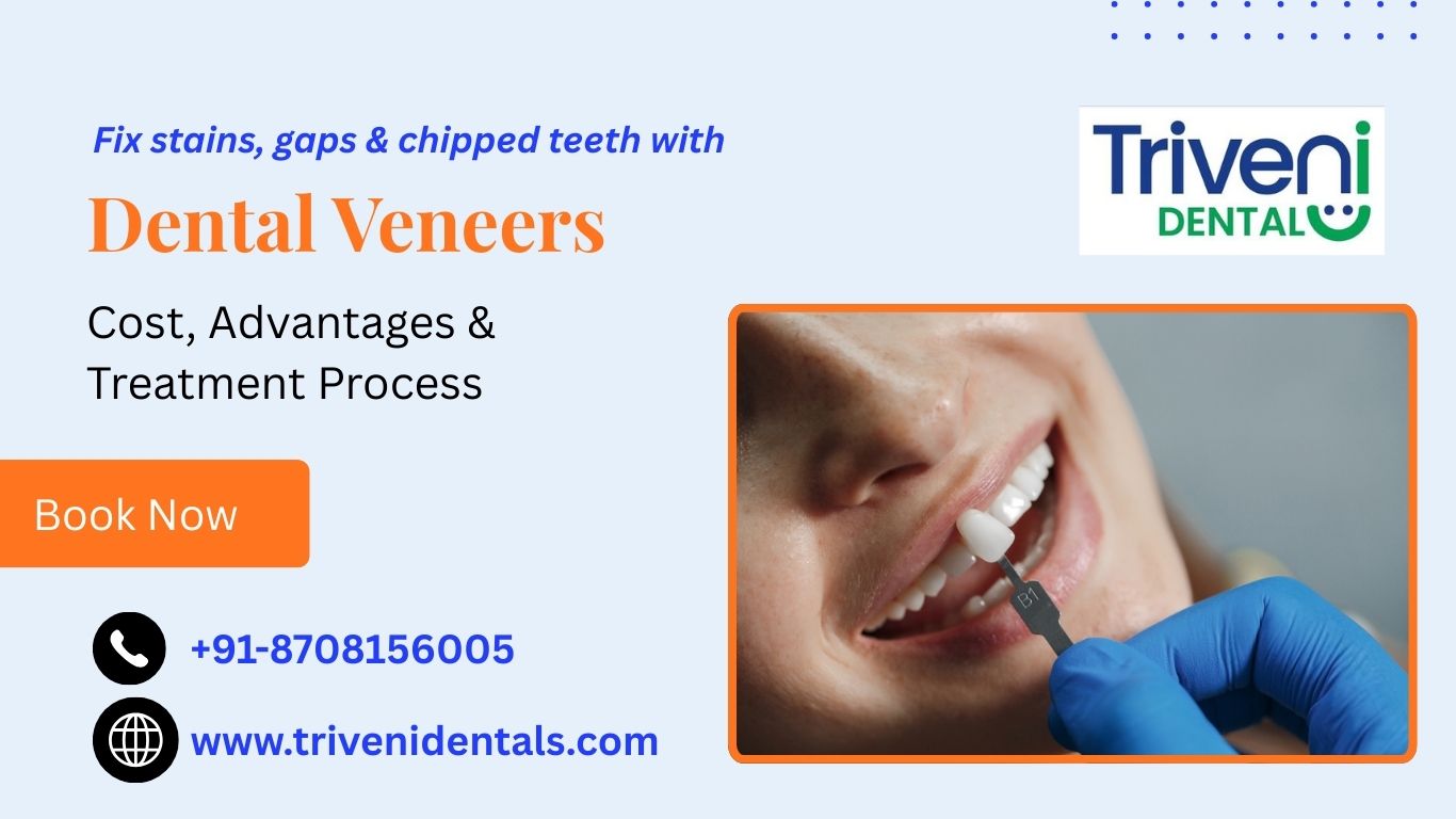 Dental Veneers – Complete Guide to a Perfect Smile