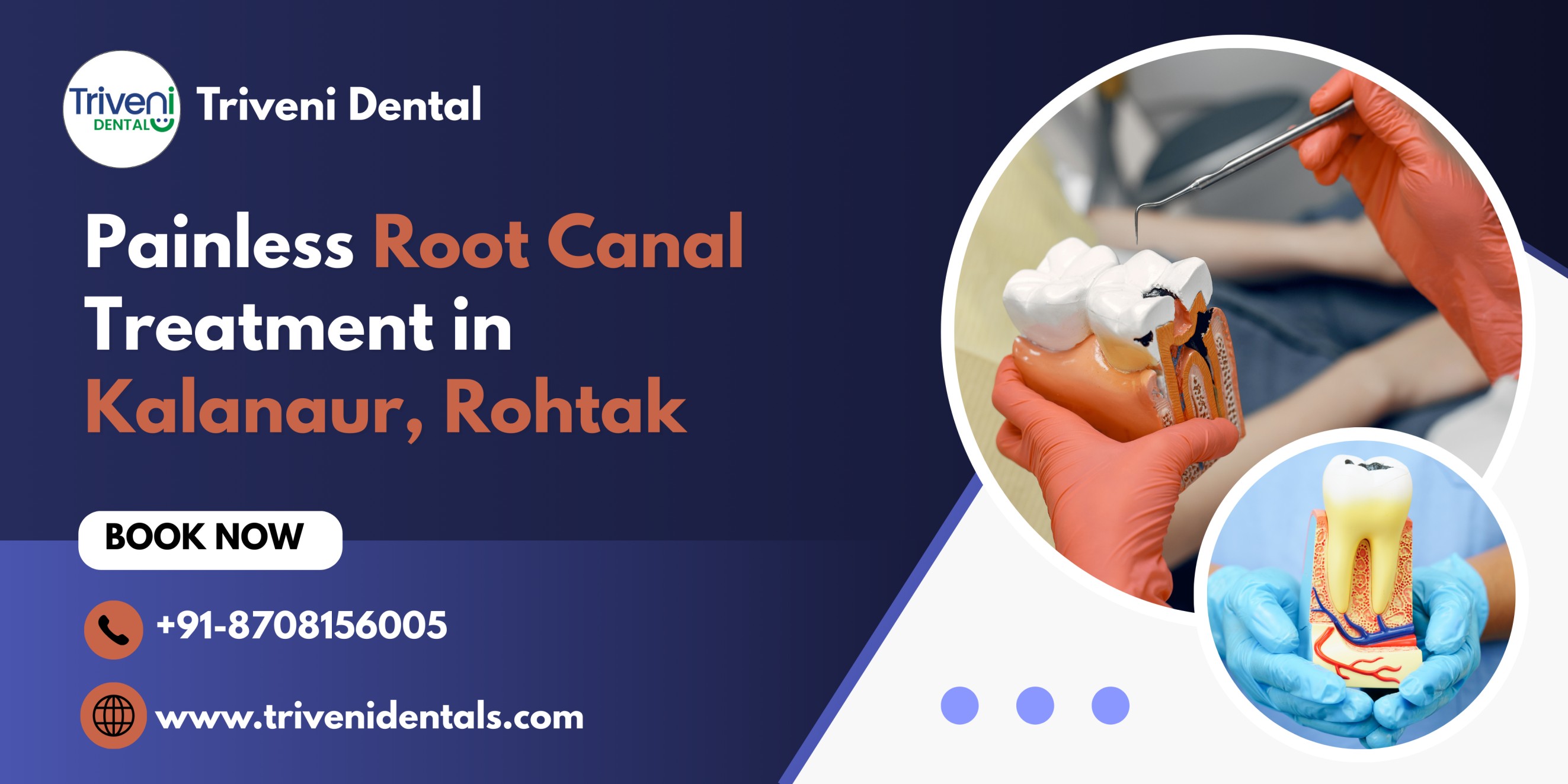 Root Canal Treatment in Kalanaur: Procedure, Cost, and Benefits Explained