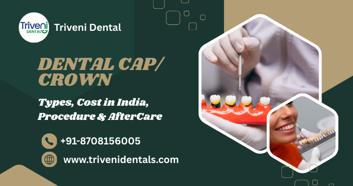 Dental Cap (Crown): Types, Cost in India, Procedure & AfterCare