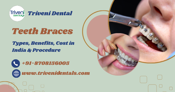 Teeth Braces: Types, Benefits, Braces Cost in India & Procedure