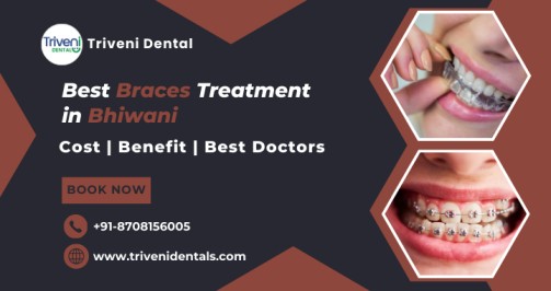 Planning for Braces Treatment in Bhiwani? Here’s What You Should Know