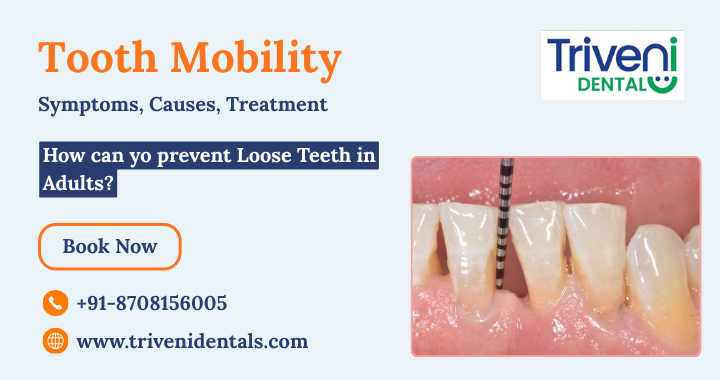 Loose Teeth in Adults: Signs and How to Treat a Loose Tooth