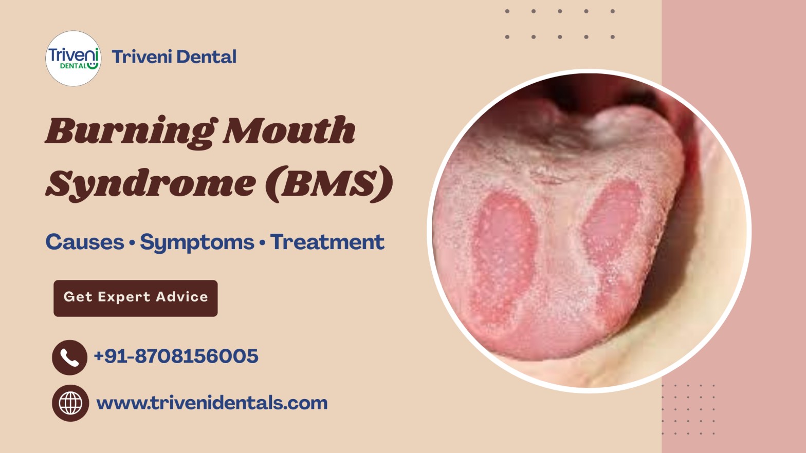 Why does my mouth burn? A complete guide to Burning Mouth Syndrome