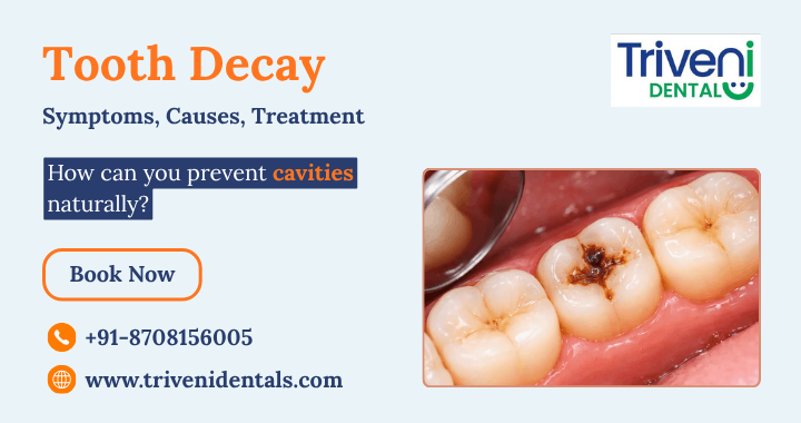 Tooth Decay (Cavities): Early Signs and How to Prevent Cavities Naturally