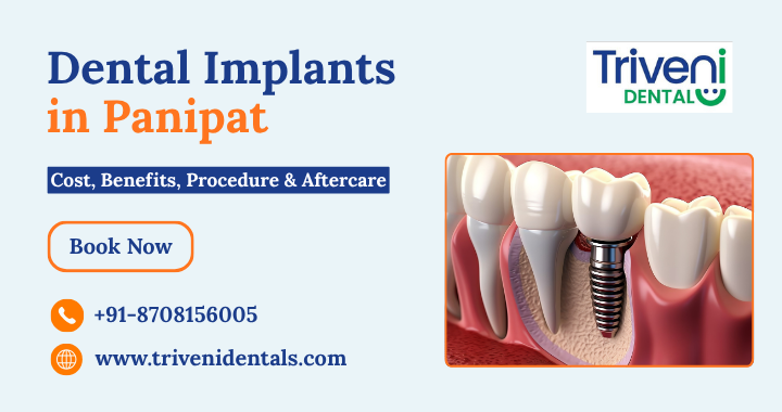 Looking for Dental Implants in Panipat? Here’s What You Need to Know