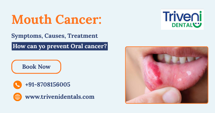Mouth Cancer: Symptoms, Causes, Prevention & Treatment