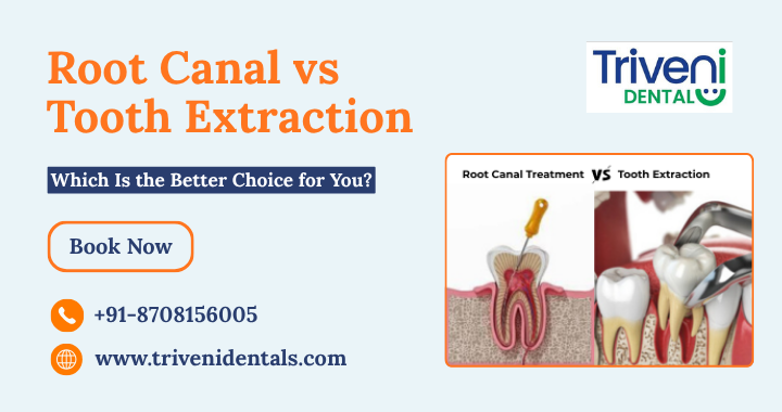 Root Canal or Tooth Extraction — Most People Choose Wrong. Here is why?