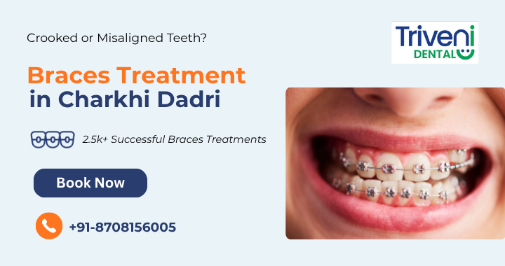 Teeth Braces Treatment in Charkhi Dadri