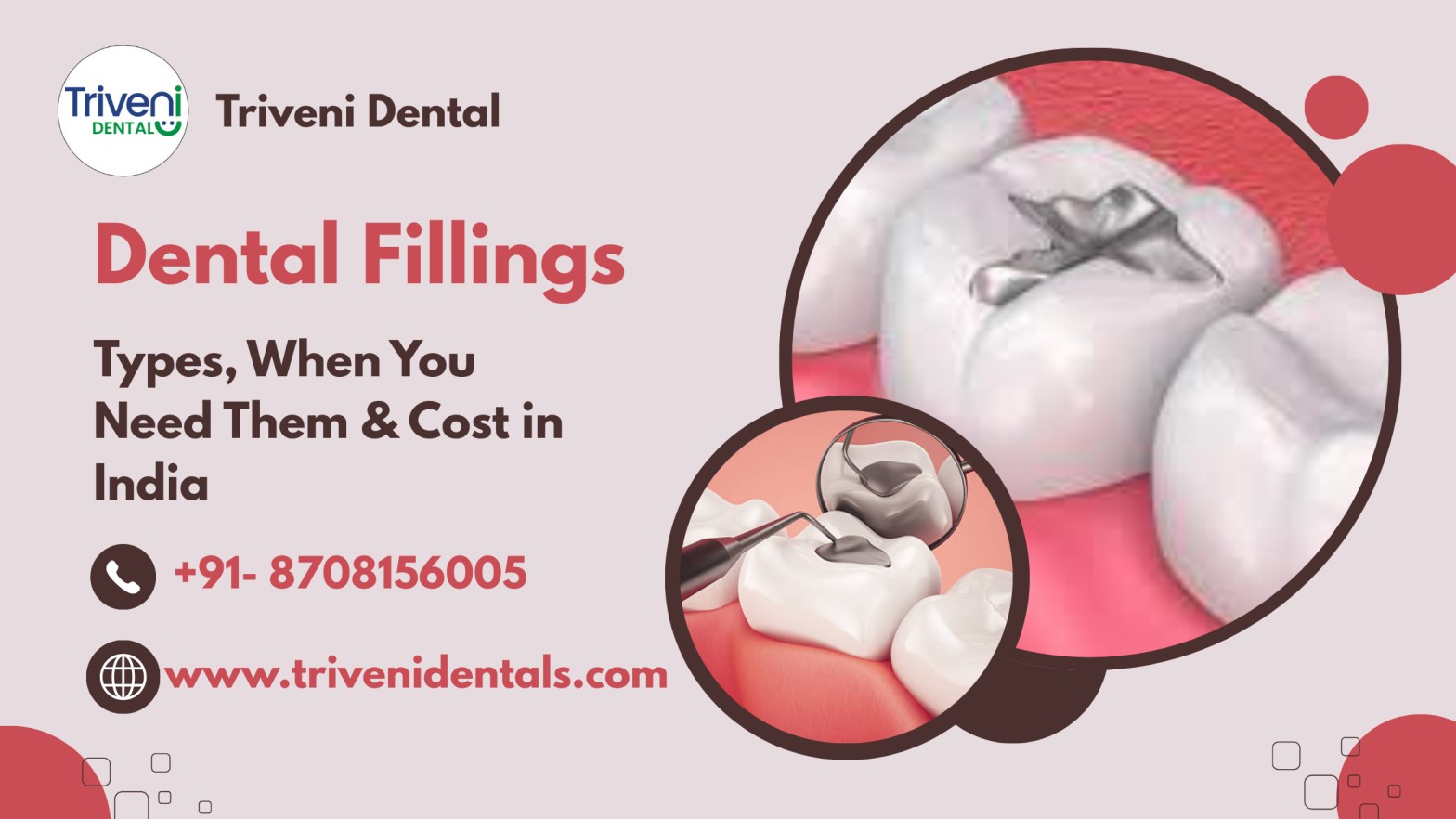 Understanding Dental Fillings: Types, Uses, and Treatment Costs in India