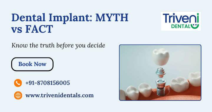 7 Dental Implant Myths you can stop believing (Facts explained)